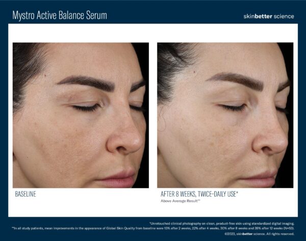 SkinBetter Science Mystro Active Balance - Image 5