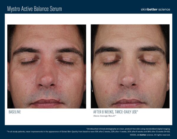 SkinBetter Science Mystro Active Balance - Image 3