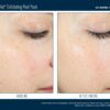 SkinBetter Science AlphaRet Exfoliating Peel Pads 30ct - Image 2