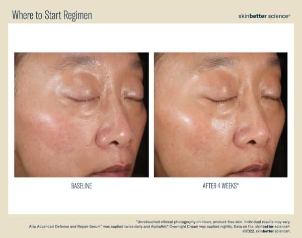 SkinBetter Science A Team Duo Advanced Kit - Image 4