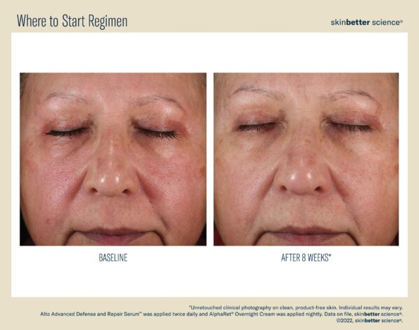 SkinBetter Science A Team Duo Advanced Kit - Image 3